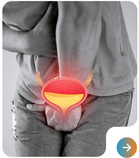 Urology Products